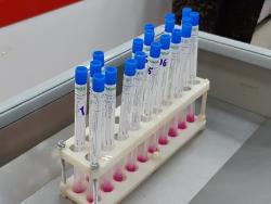 В сетевых магазинах взяли пробы на COVID-19